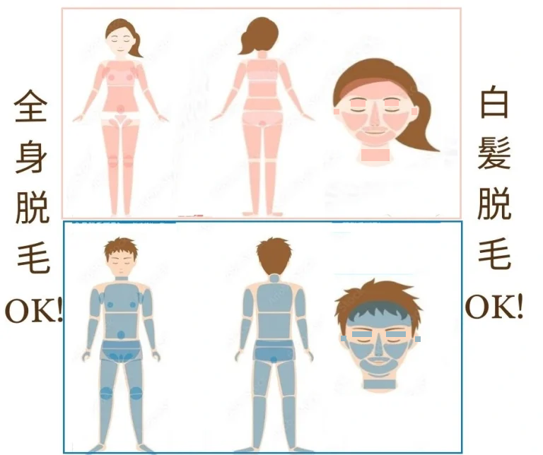 全身の電気脱毛大阪